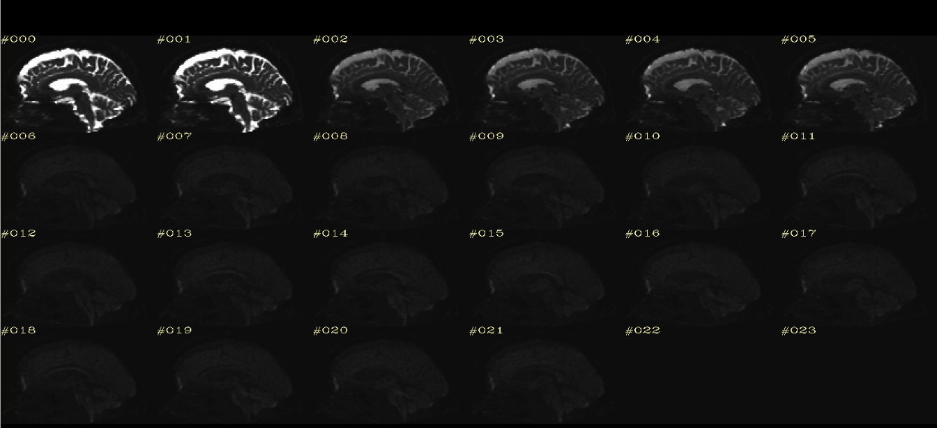 Processed DWI Sagittal