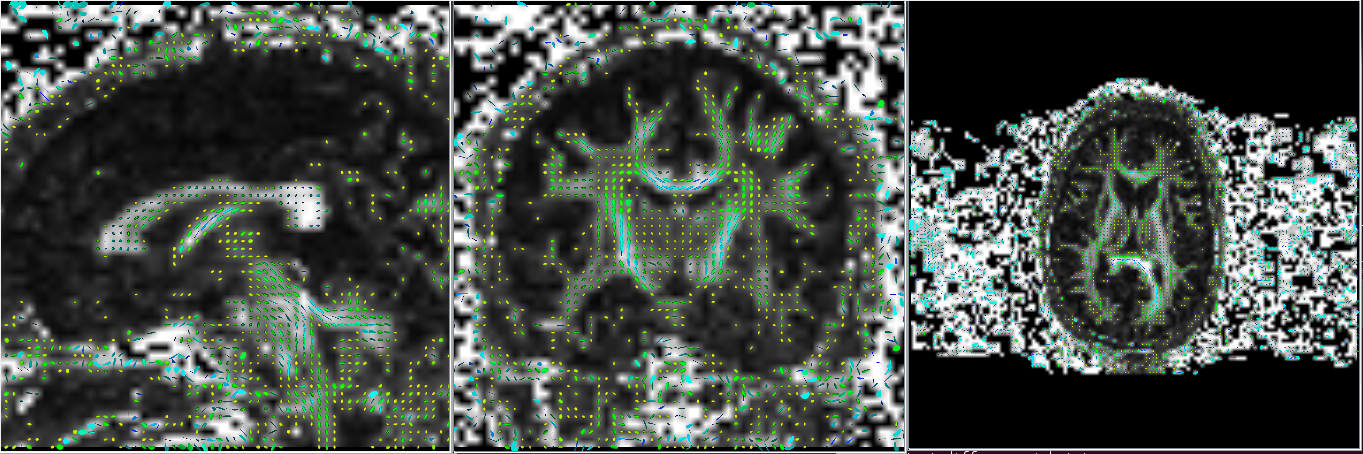 ComputeGlyphMaps full path to tensor NIFTI file axis slice number full path to output-Correct