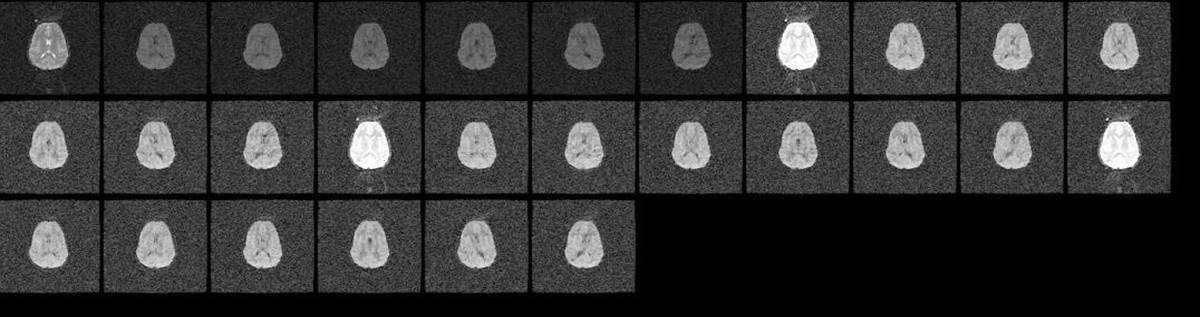 11.5. second artifact image of first replicates with different signal gain then the rest