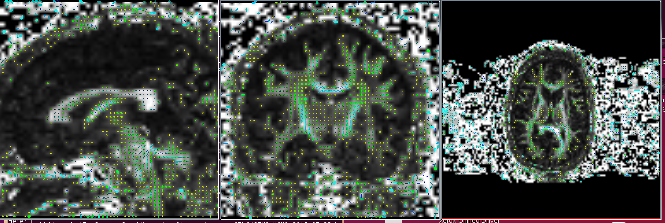 ComputeGlyphMaps full path to tensor NIFTI file axis slice number full path to output-Incorrect