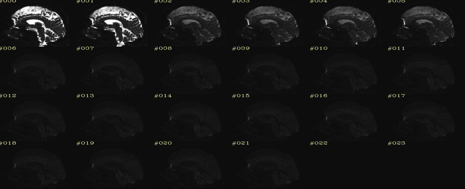 raw dwi Sagittal