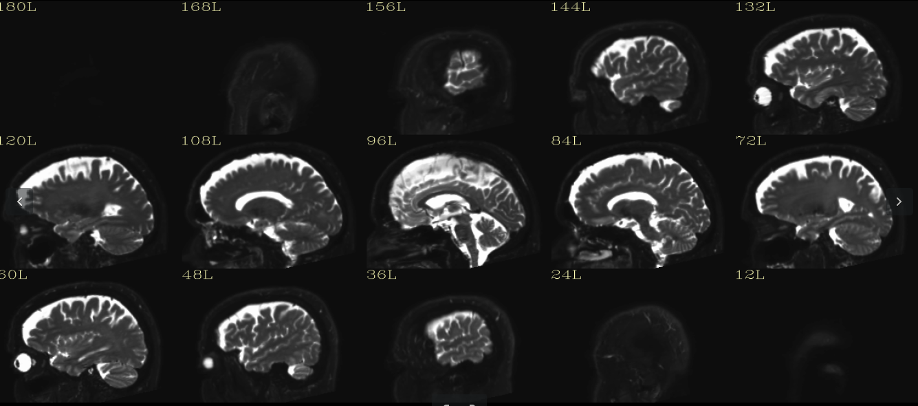 structural Sagittal